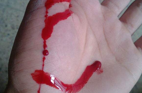 gore